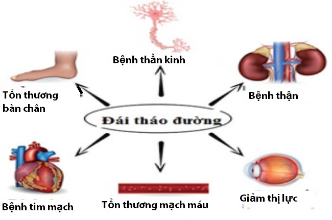 Bệnh tiểu đường - triệu chứng và cách điều trị